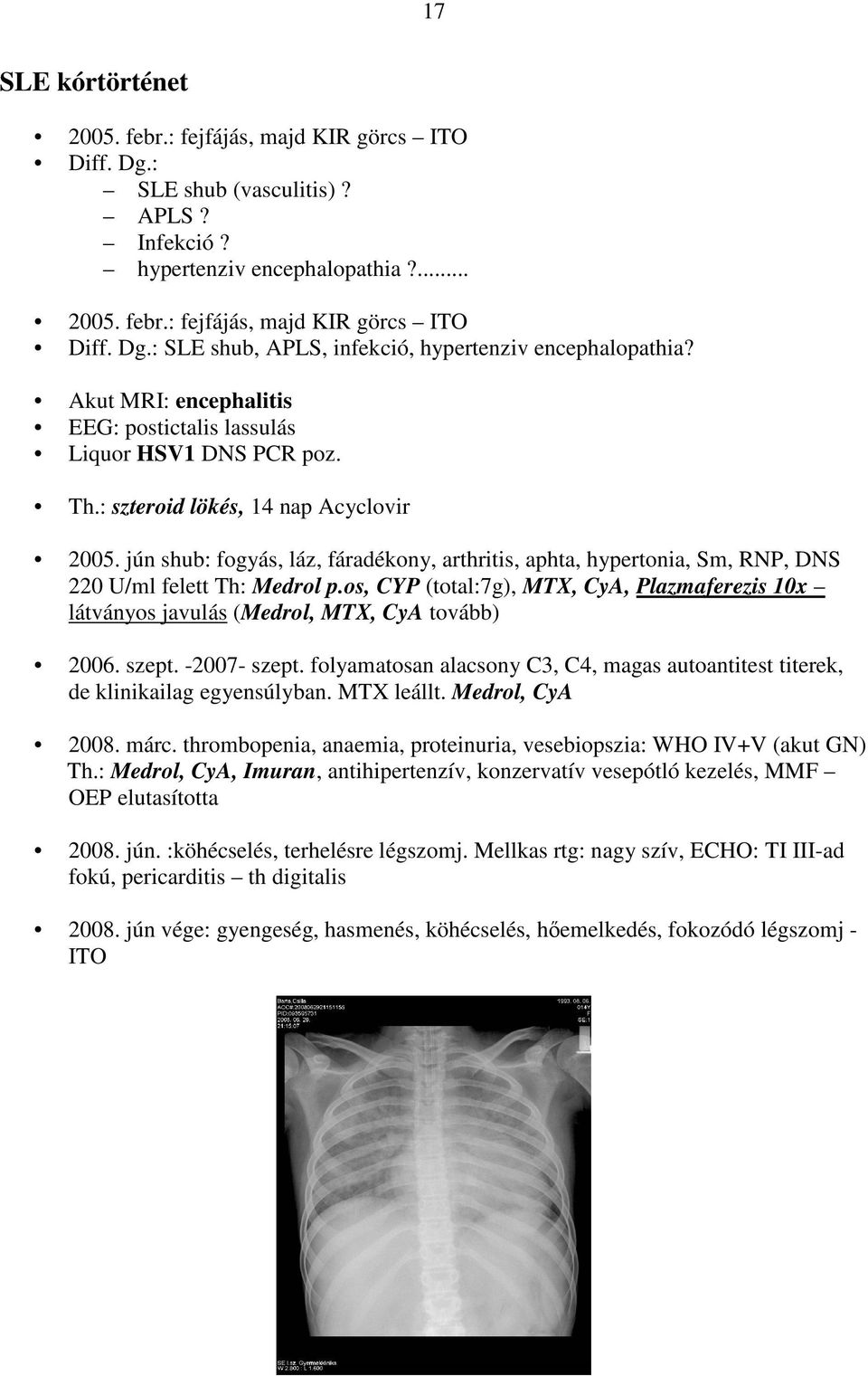 jún shub: fogyás, láz, fáradékony, arthritis, aphta, hypertonia, Sm, RNP, DNS 220 U/ml felett Th: Medrol p.