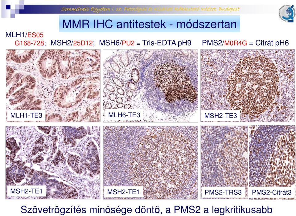 módszertan MSH2/25D12; MSH6/PU2 = Tris-EDTA ph9 PMS2/M0R4G = Citrát ph6