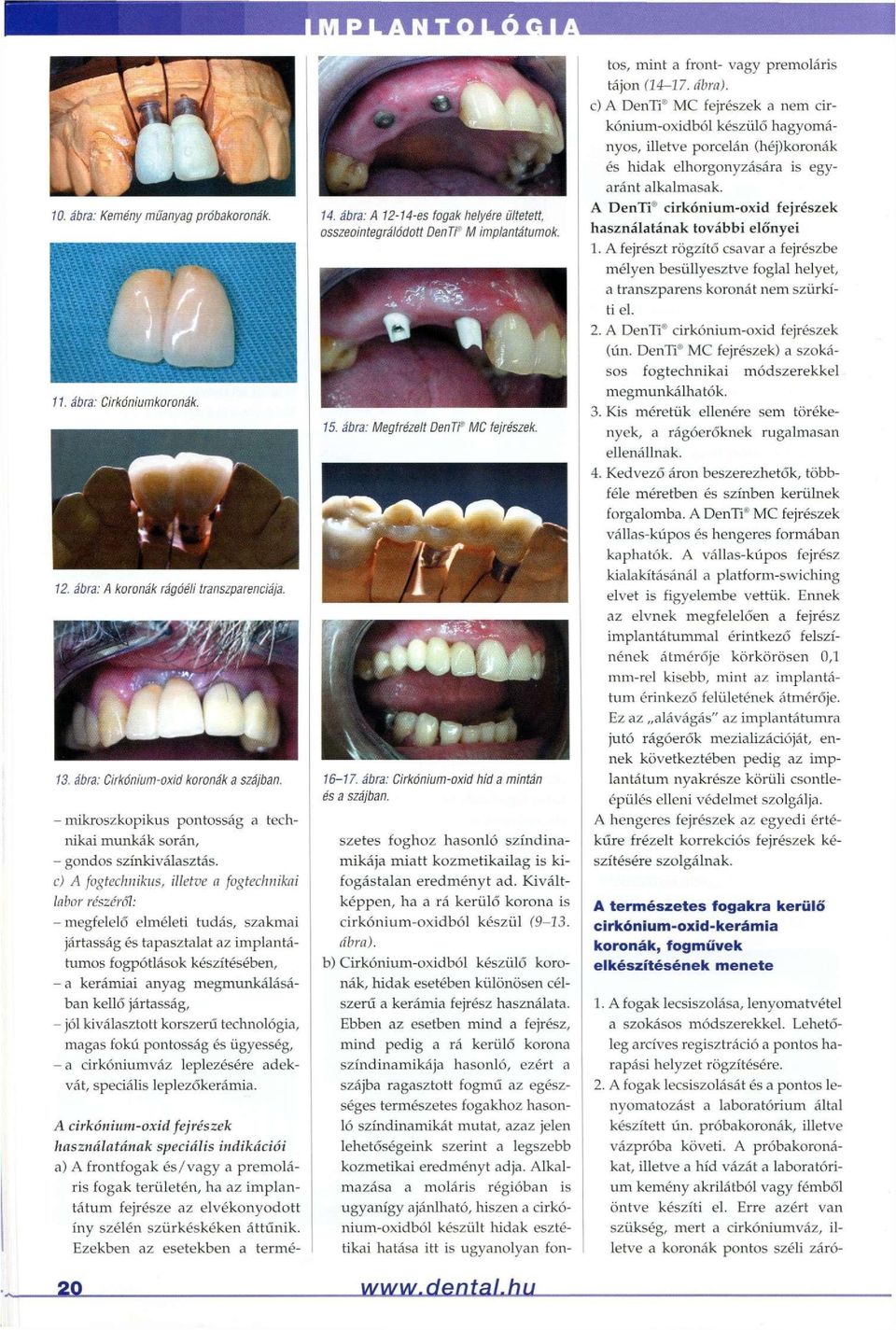 c) A fogtechnikus, illetve a fogtechnikai labor részéről: - megfelelő elméleti tudás, szakmai jártasság és tapasztalat az implantátumos fogpótlások készítésében, - a kerámiai anyag megmunkálásában