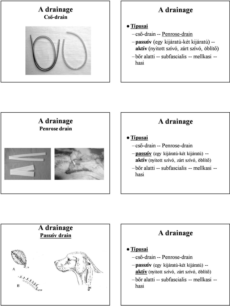 kijáratú) aktív (nyitott szívó, zárt szívó, öblítő) bőr alatti subfascialis mellkasi hasi Passzív drain Típusai cső