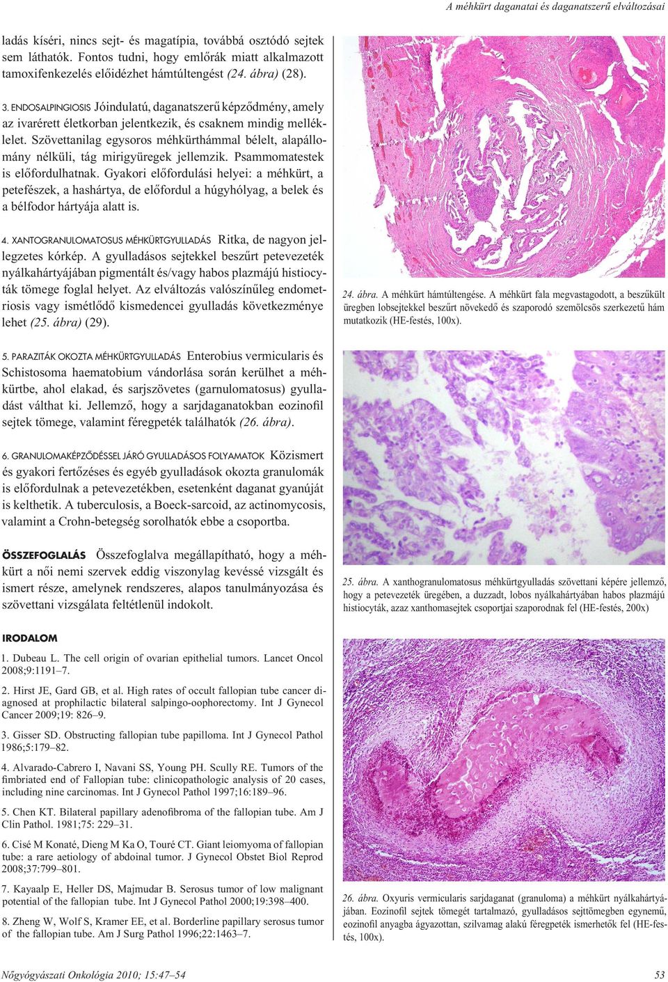 ENDOSALPINGIOSIS Jóindulatú, daganatszerû képzôdmény, amely az ivarérett életkorban jelentkezik, és csaknem mindig melléklelet.