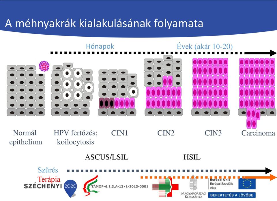 epithelium HPV fertőzés; koilocytosis
