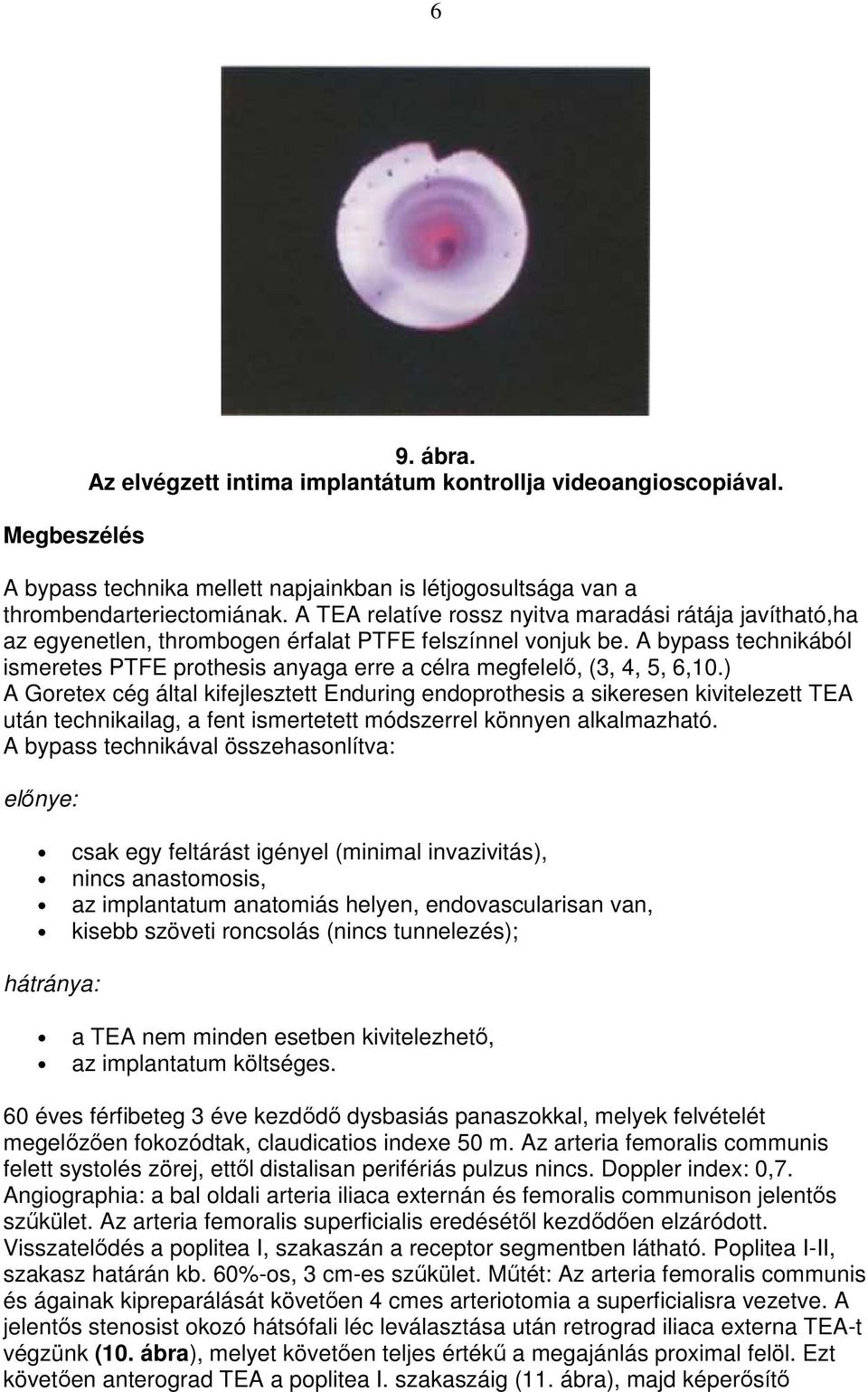 A bypass technikából ismeretes PTFE prothesis anyaga erre a célra megfelelı, (3, 4, 5, 6,10.