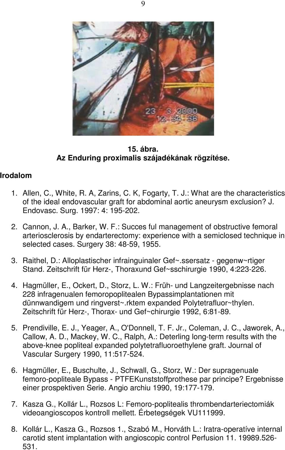 : Succes ful management of obstructive femoral arteriosclerosis by endarterectomy: experience with a semiclosed technique in selected cases. Surgery 38: 48-59, 1955. 3. Raithel, D.