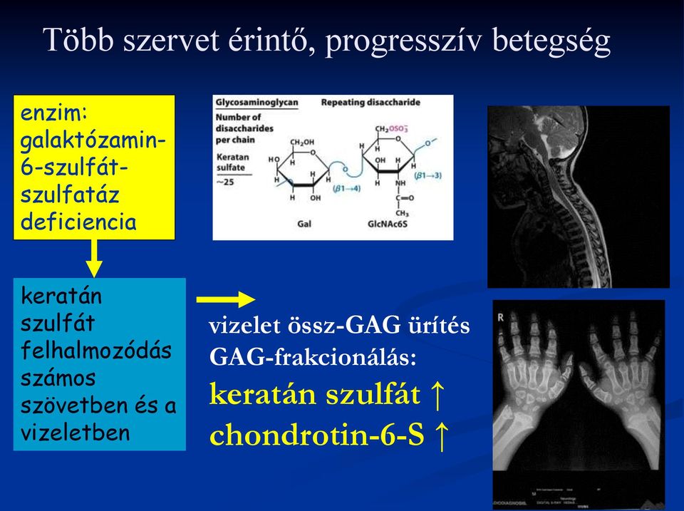 szulfát felhalmozódás számos szövetben és a vizeletben