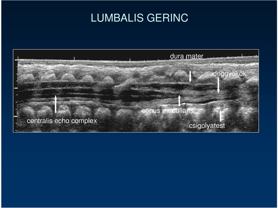 centralis echo complex