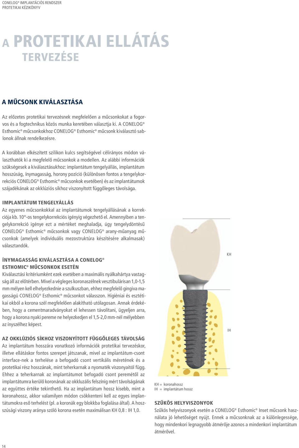 Az alábbi információk szükségesek a kiválasztásukhoz: implantátum tengelyállás, implantátum hosszúság, ínymagasság, horony pozíció (különösen fontos a tengelykorrekciós Esthomic műcsonkok esetében)