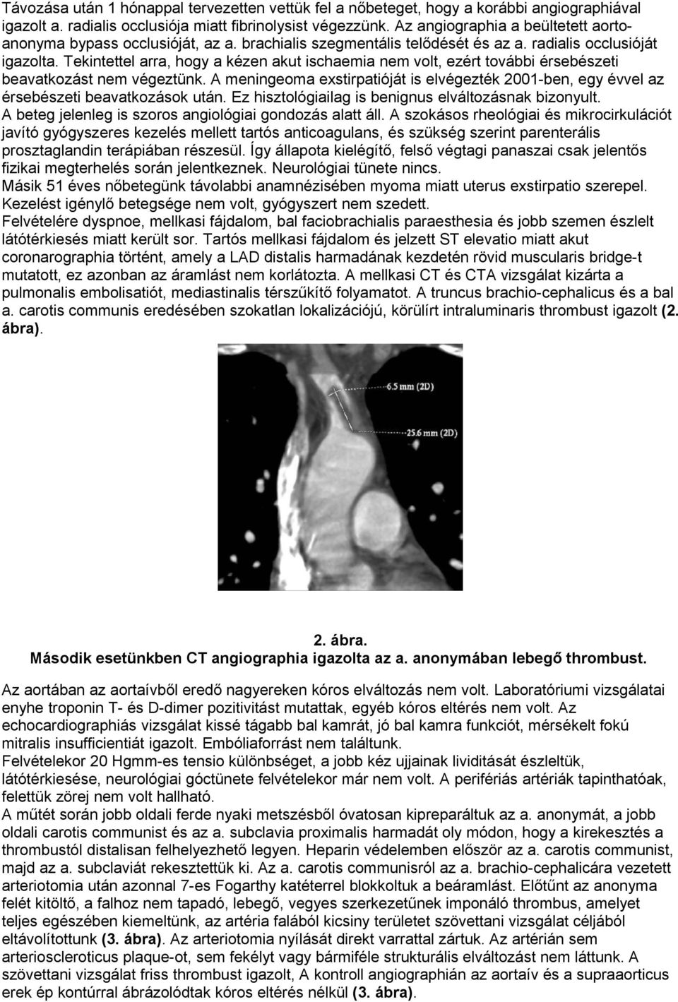 Tekintettel arra, hogy a kézen akut ischaemia nem volt, ezért további érsebészeti beavatkozást nem végeztünk.