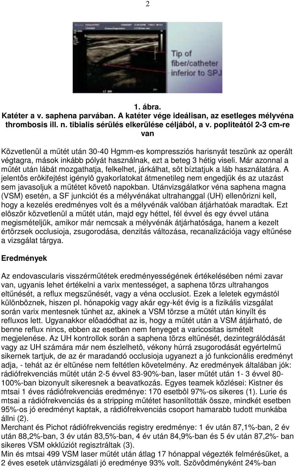 Már azonnal a mőtét után lábát mozgathatja, felkelhet, járkálhat, sôt bíztatjuk a láb használatára.