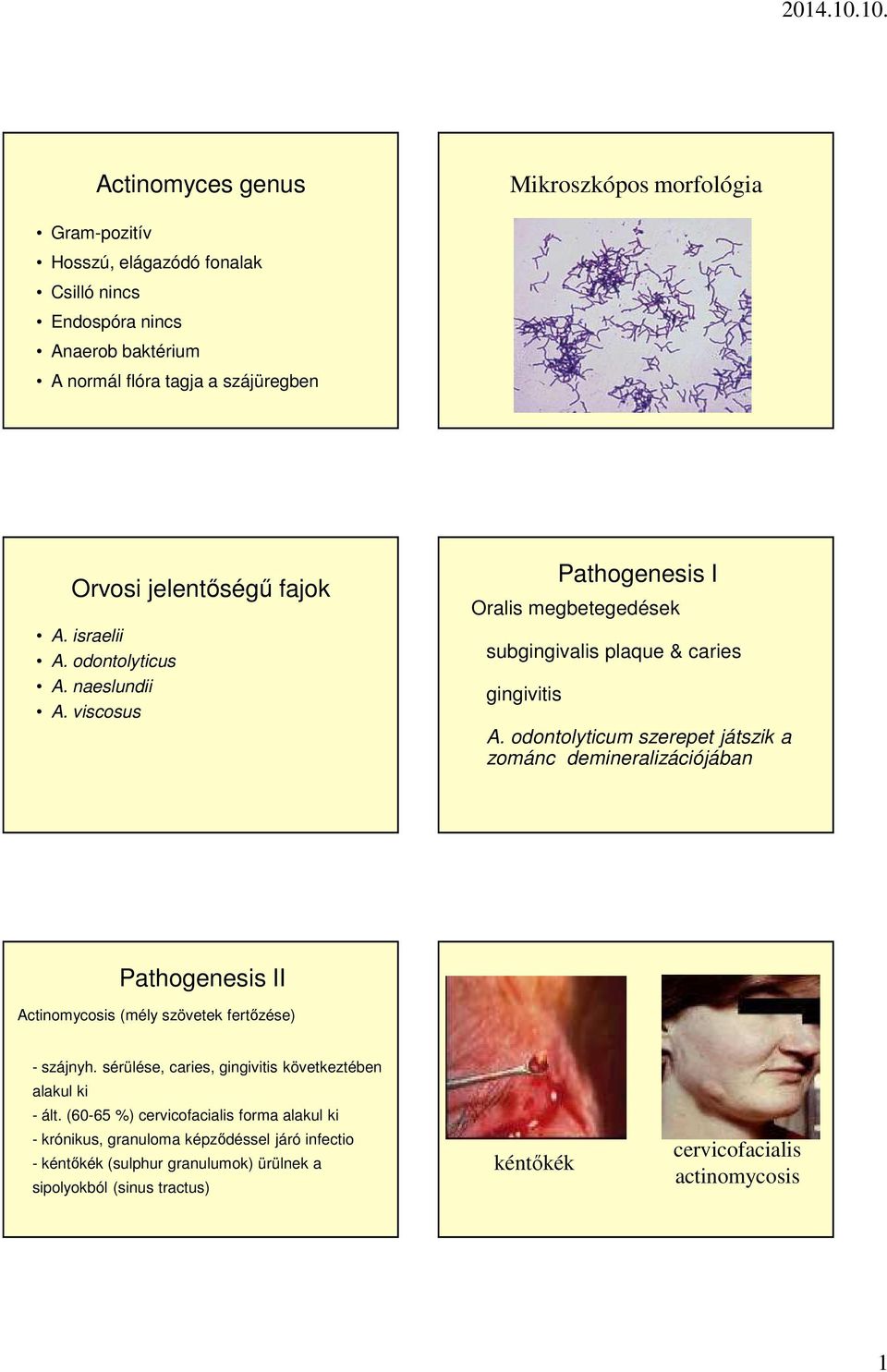 odontolyticum szerepet játszik a zománc demineralizációjában Pathogenesis II Actinomycosis (mély szövetek fertőzése) - szájnyh.