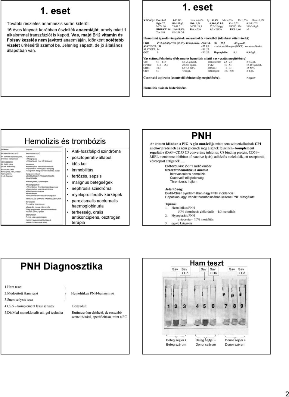 . eset Vérkép: Fvs: 3,45 4-3 G/L Neu: 44,4 % Ly: 48,4% Mo: 4,9% o:,7% Baso: 0,6% Hgb: 77 0-55 g/l Htk: 0,26 0,34-0,47 L/L Vvt: 2,72 4,2-5, T/L MV: 90 73-9 fl MH: 28,3 27,3-32,6 pg MH: 324 36-349 g/l