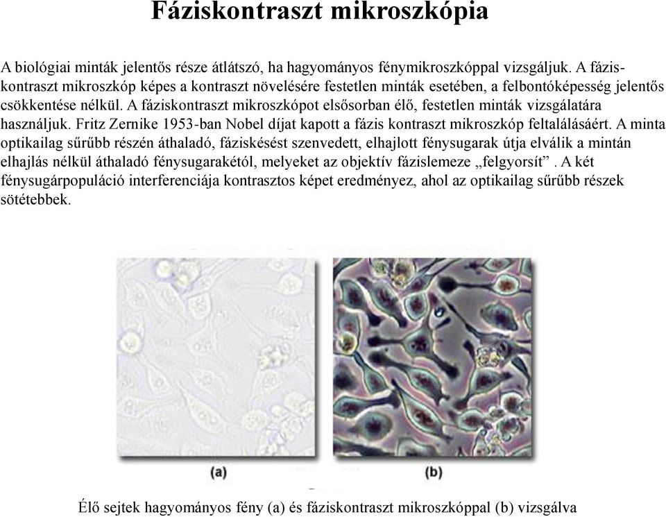 A fáziskontraszt mikroszkópot elsősorban élő, festetlen minták vizsgálatára használjuk. Fritz Zernike 1953-ban Nobel díjat kapott a fázis kontraszt mikroszkóp feltalálásáért.