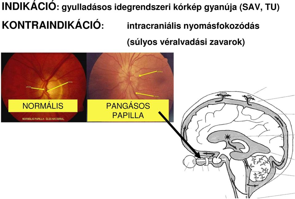 KONTRAINDIKÁCIÓ: intracraniális