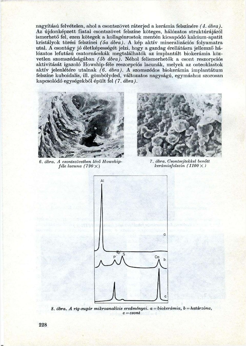 A kép aktív mineralizációs folyamatra utal.