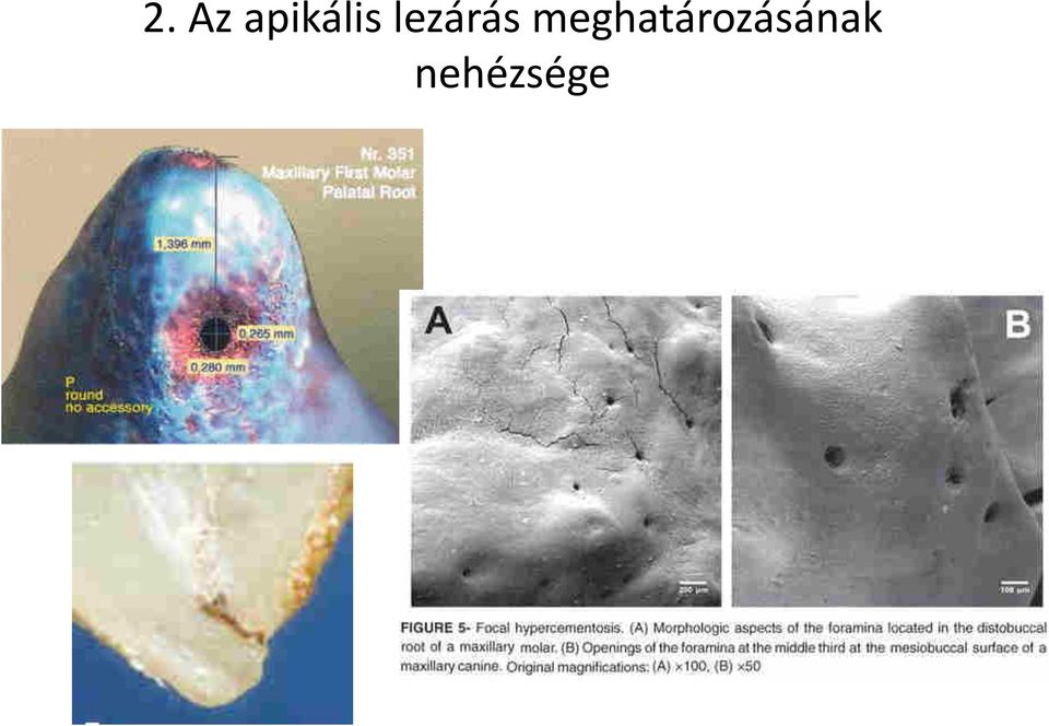 lezárás