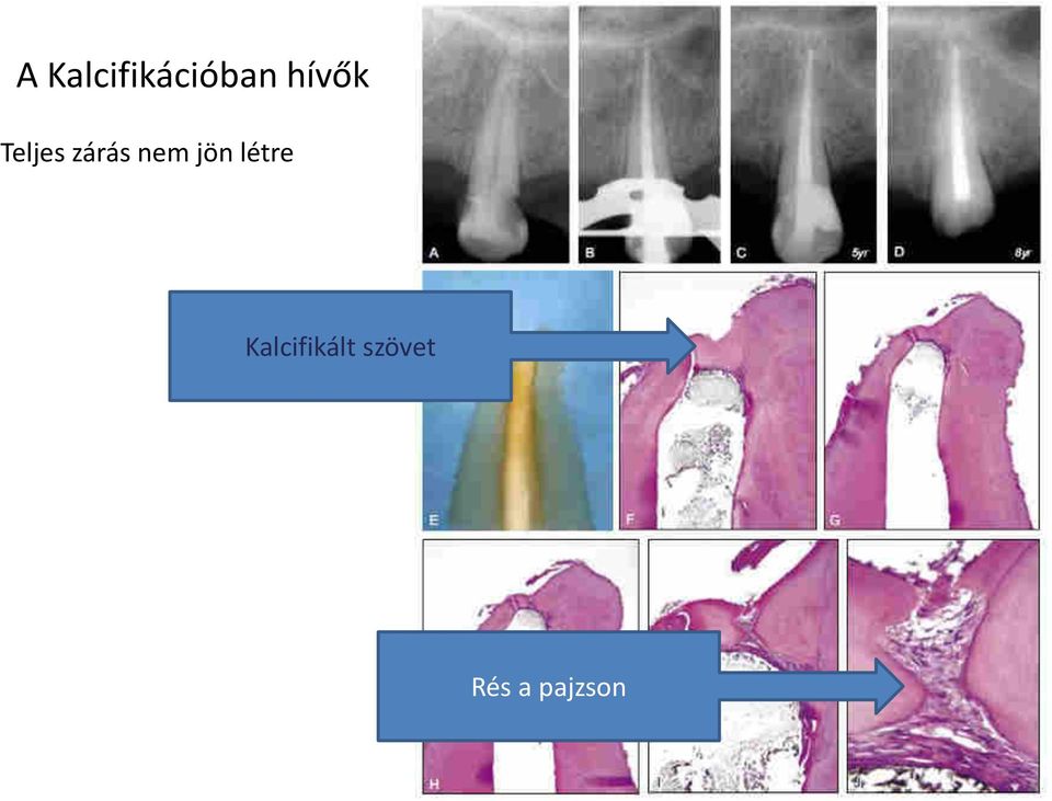 nem jön létre