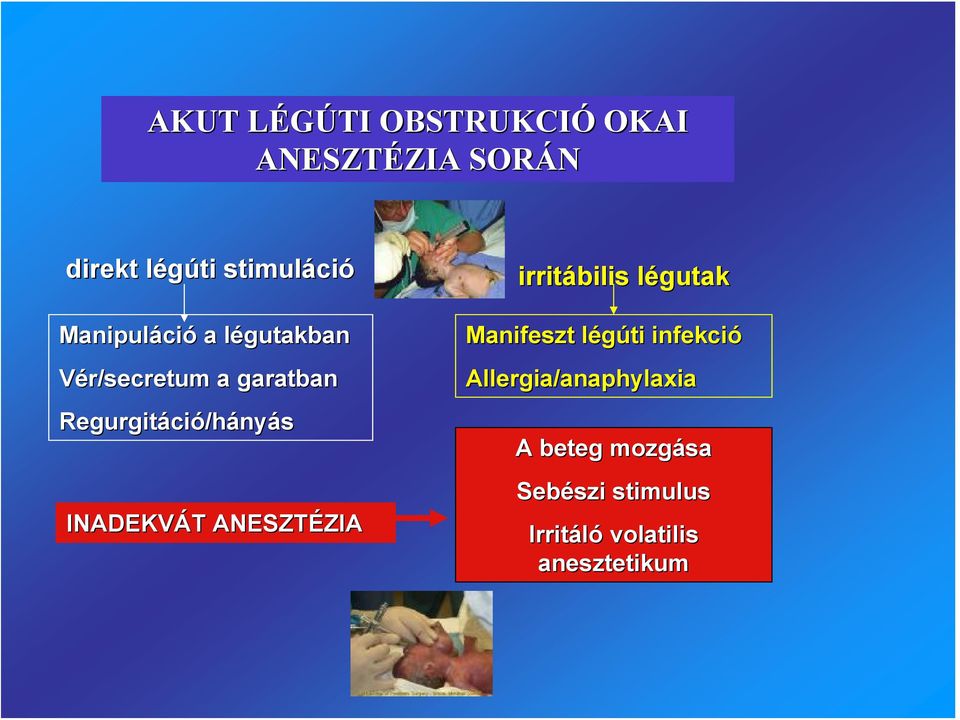 INADEKVÁT ANESZTÉZIA irritábilis légutak Manifeszt légúti infekció