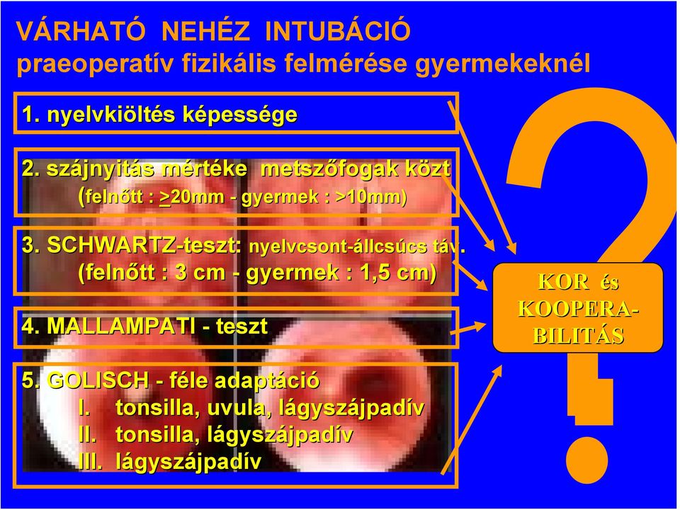 SCHWARTZ-teszt: nyelvcsont (felnőtt : 3 cm - gyermek : 1,5 cm) 4.
