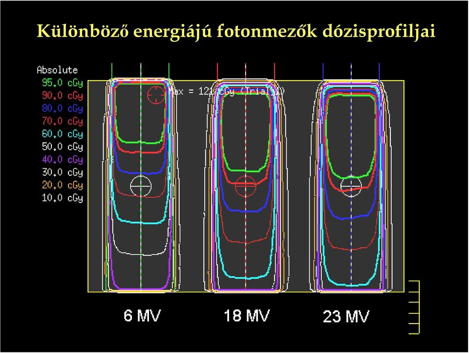 fotonmezők