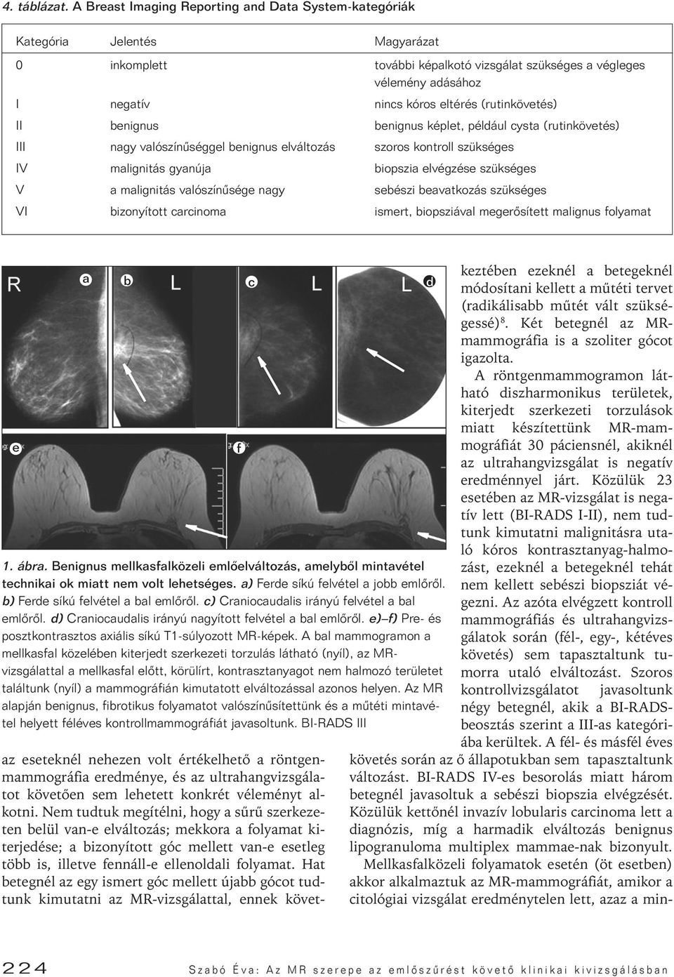 (rutinkövetés) II benignus benignus képlet, például cysta (rutinkövetés) III nagy valószínûséggel benignus elváltozás szoros kontroll szükséges IV malignitás gyanúja biopszia elvégzése szükséges V a