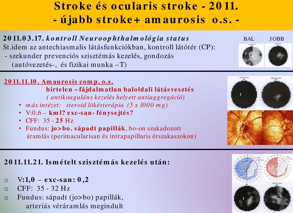 exc-san- fénysejtés? CFF: 35-25 Hz Fundus: jo>bo. sápadt papillák, bo-on szakadozott áramlás (perimacularisan és intrapapillaris érszakaszokon) 2011.11.21.