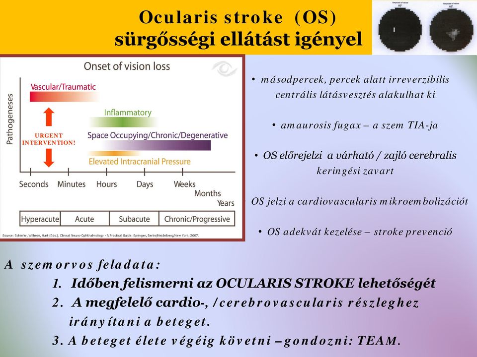 amaurosis fugax a szem TIA-ja OS előrejelzi a várható / zajló cerebralis keringési zavart OS jelzi a cardiovascularis