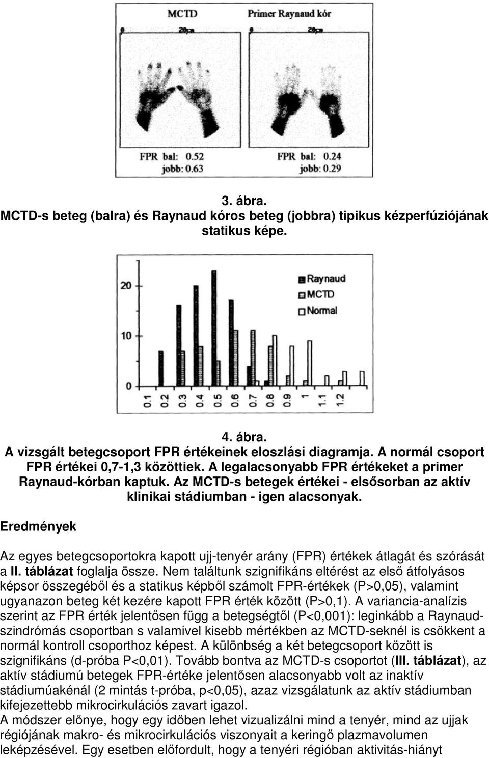 Eredmények Az egyes betegcsoportokra kapott ujj-tenyér arány (FPR) értékek átlagát és szórását a II. táblázat foglalja össze.