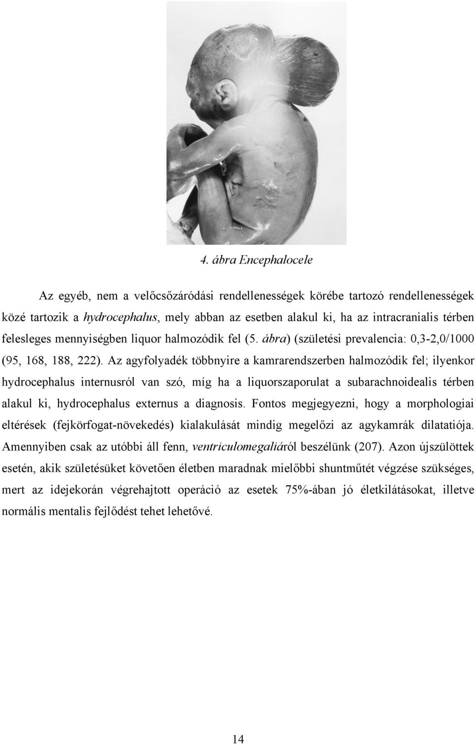 Az agyfolyadék többnyire a kamrarendszerben halmozódik fel; ilyenkor hydrocephalus internusról van szó, míg ha a liquorszaporulat a subarachnoidealis térben alakul ki, hydrocephalus externus a