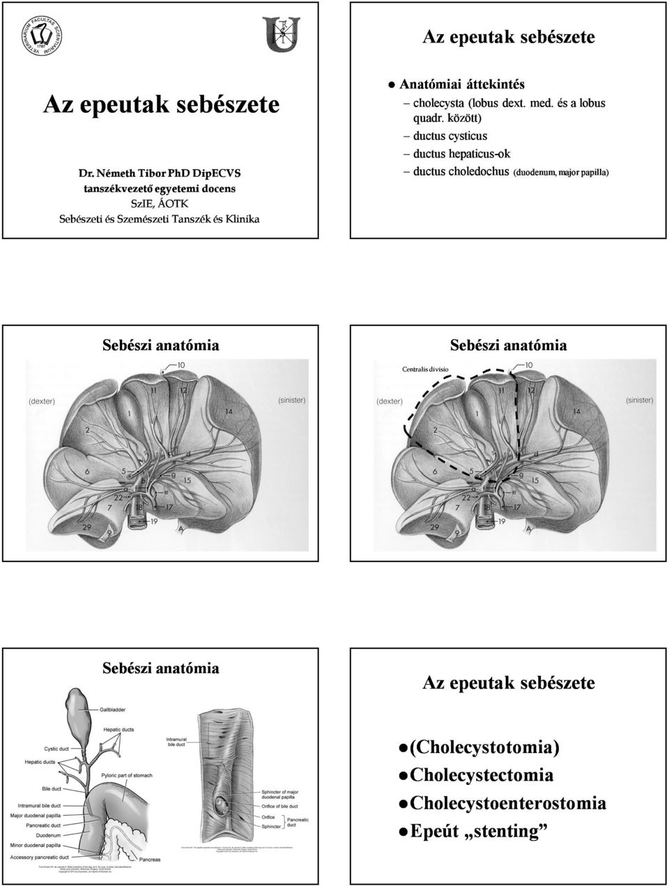 Anatómiai áttekintés cholecysta (lobus dext. med. és a lobus quadr.
