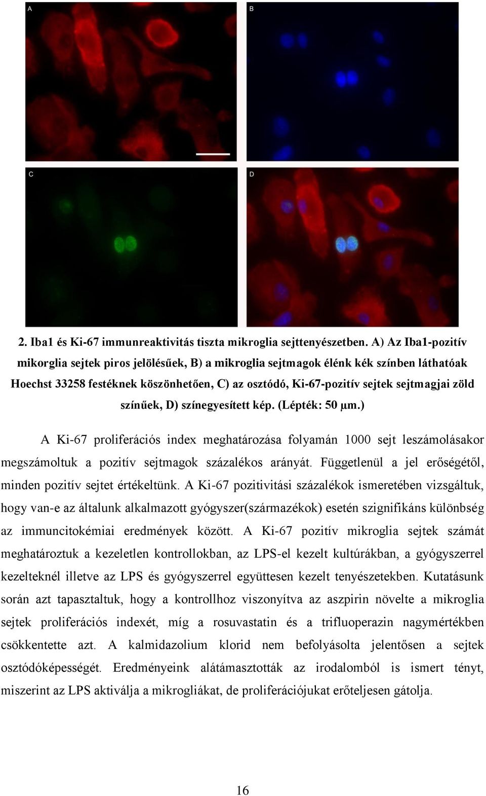 színűek, D) színegyesített kép. (Lépték: 50 µm.) A Ki-67 proliferációs index meghatározása folyamán 1000 sejt leszámolásakor megszámoltuk a pozitív sejtmagok százalékos arányát.