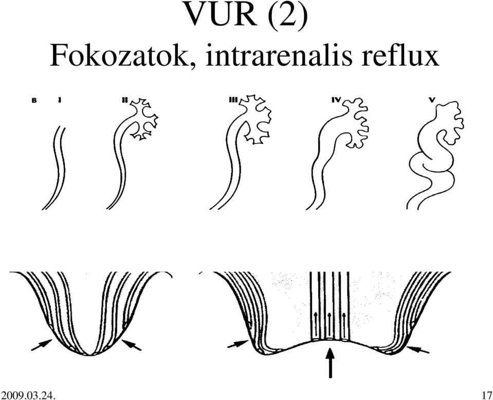 intrarenalis