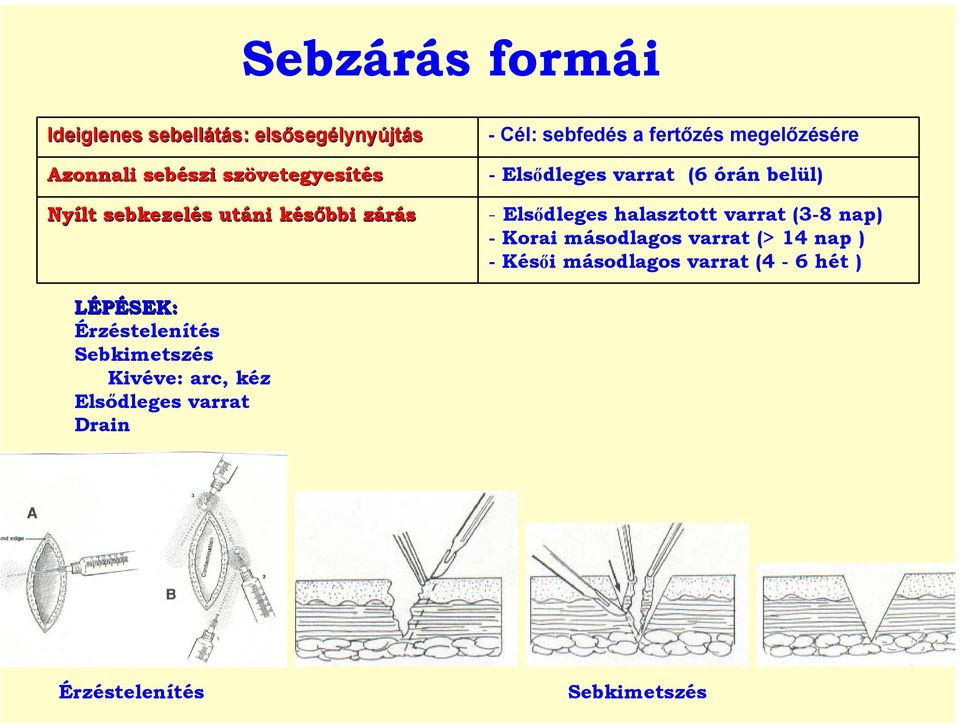 belül) - Elsődleges halasztott varrat (3-8 nap) - Korai másodlagos varrat (> 14 nap ) -Késői másodlagos varrat