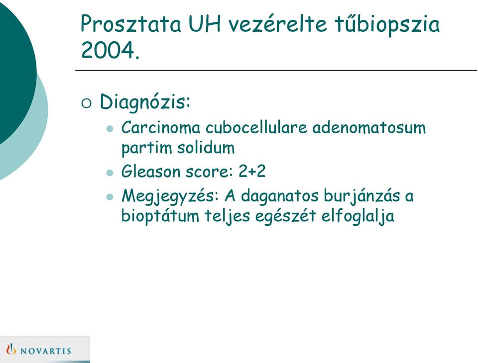 partim solidum Gleason score: 2+2 Megjegyzés: A