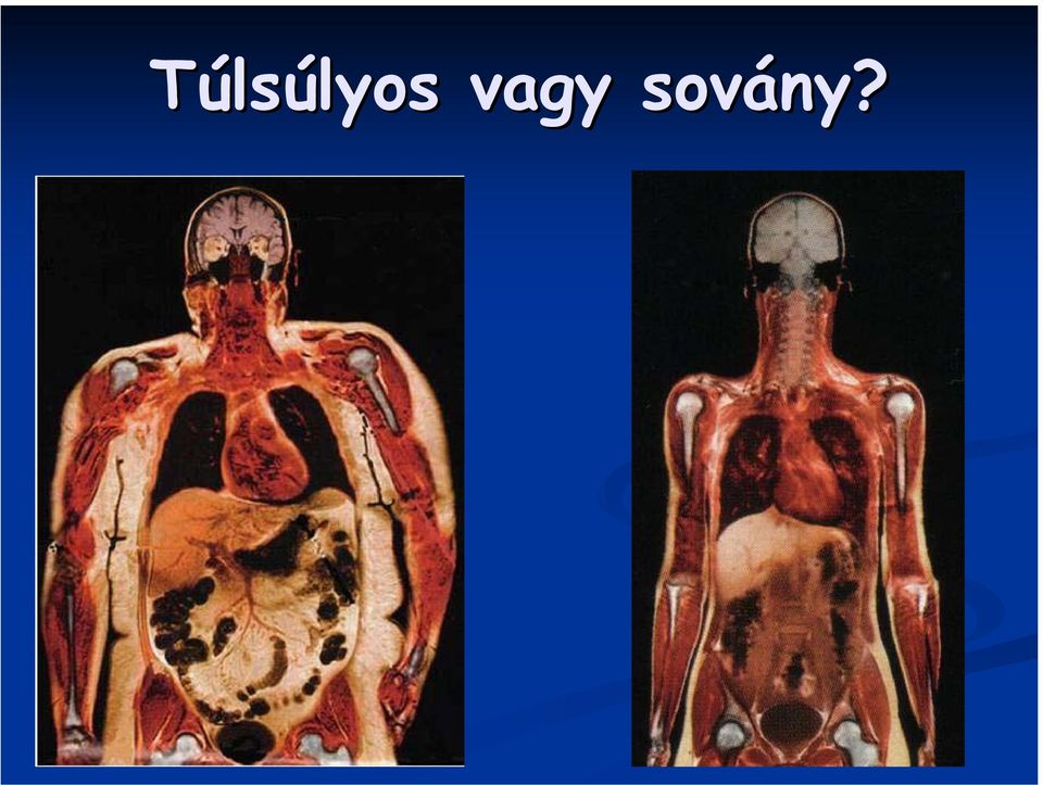 sovány?