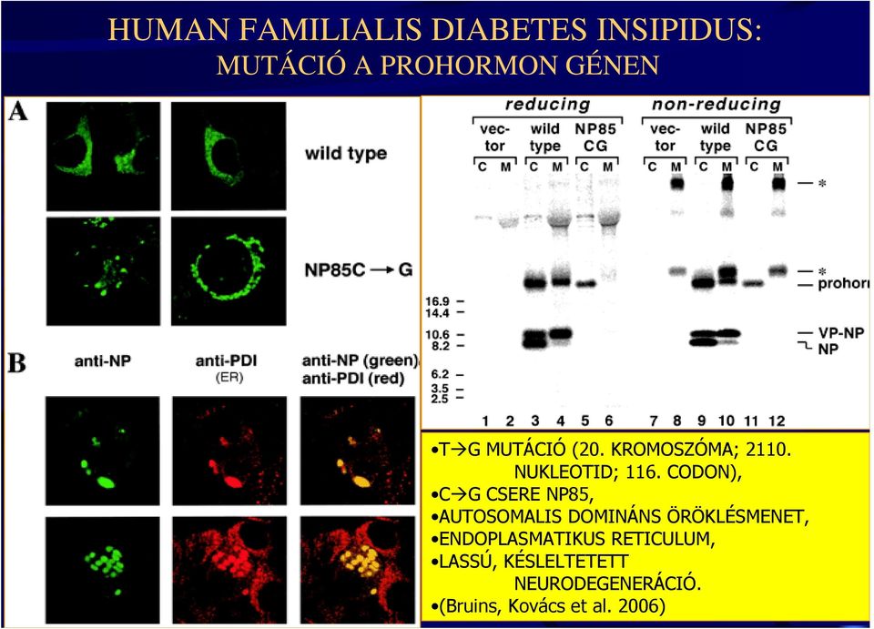 CODON), C G CSERE NP85, AUTOSOMALIS DOMINÁNS ÖRÖKLÉSMENET,