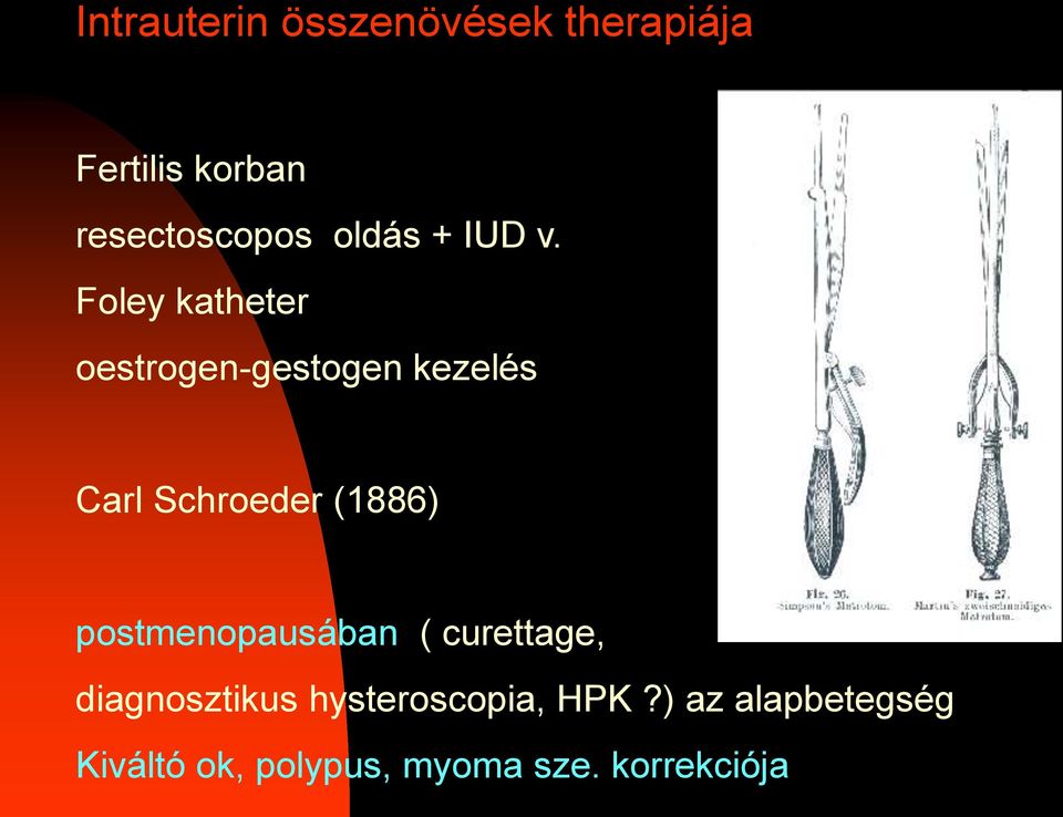 Foley katheter oestrogen-gestogen kezelés Carl Schroeder (1886)