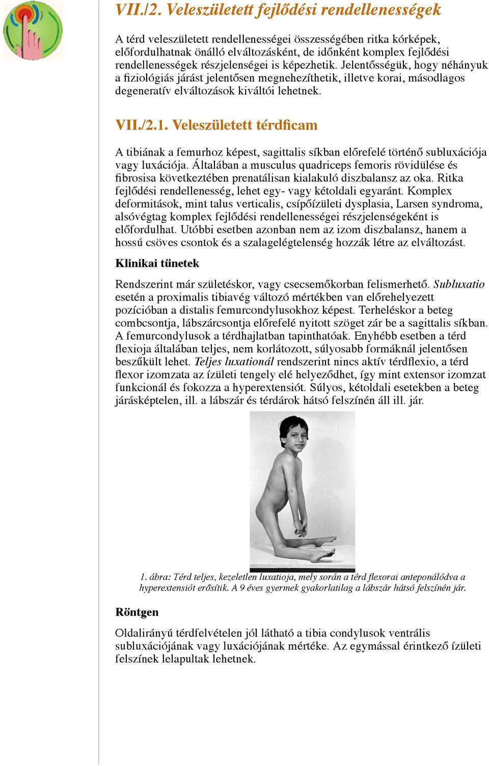 részjelenségei is képezhetik. Jelentősségük, hogy néhányuk a fiziológiás járást jelentősen megnehezíthetik, illetve korai, másodlagos degeneratív elváltozások kiváltói lehetnek. 1.