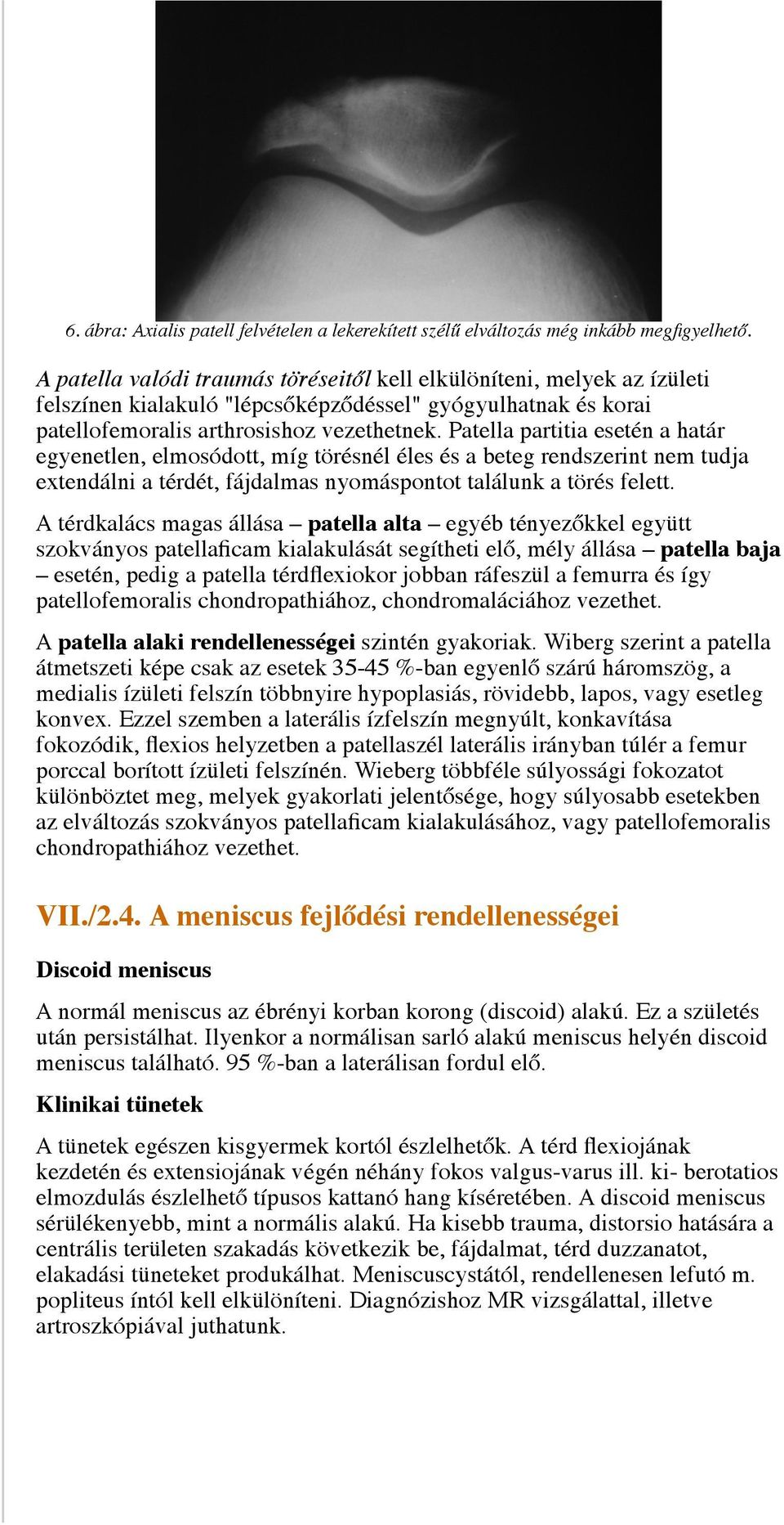 Patella partitia esetén a határ egyenetlen, elmosódott, míg törésnél éles és a beteg rendszerint nem tudja extendálni a térdét, fájdalmas nyomáspontot találunk a törés felett.