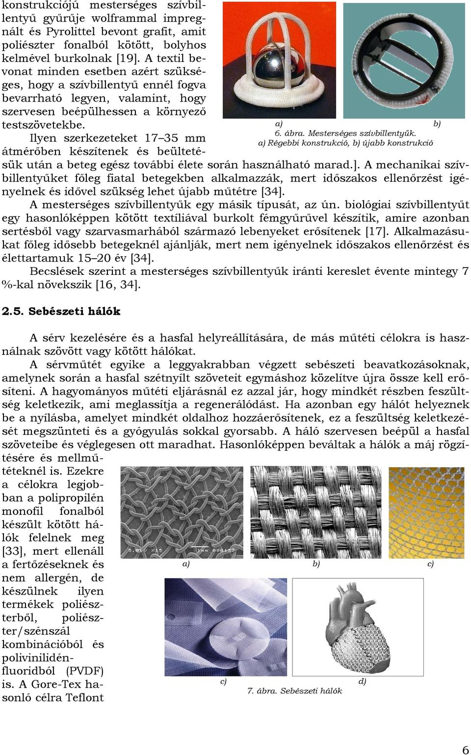 Mesterséges szívbillentyűk. Ilyen szerkezeteket 17 35 mm a) Régebbi konstrukció, b) újabb konstrukció átmérőben készítenek és beültetésük után a beteg egész további élete során használható marad.].