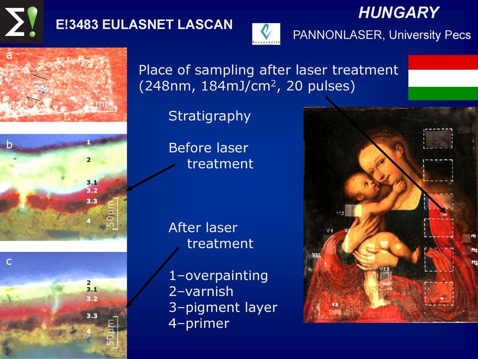 pulses) Stratigraphy Before laser treatment After