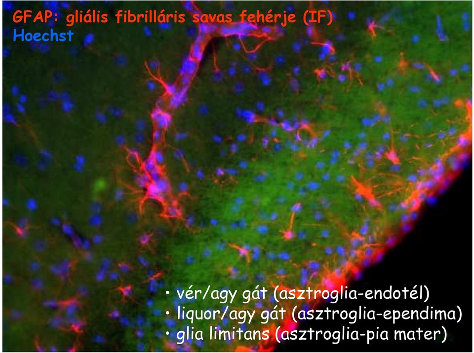 (asztroglia-endotél) liquor/agy gát
