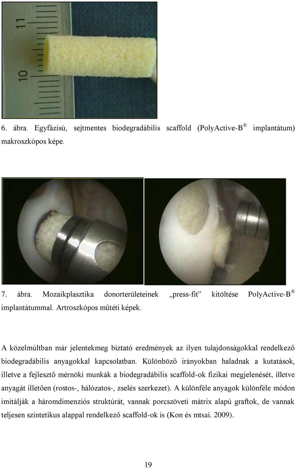 Különböző irányokban haladnak a kutatások, illetve a fejlesztő mérnöki munkák a biodegradábilis scaffold-ok fizikai megjelenését, illetve anyagát illetően (rostos-, hálózatos-, zselés