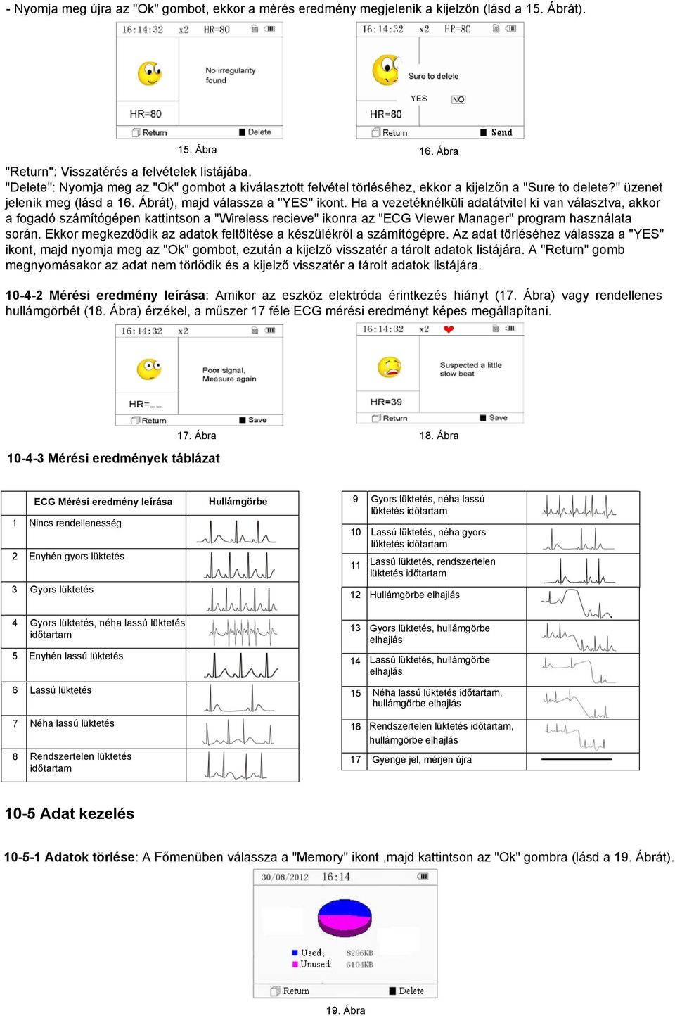 Ha a vezetéknélküli adatátvitel ki van választva, akkor a fogadó számítógépen kattintson a "Wireless recieve" ikonra az "ECG Viewer Manager" program használata során.