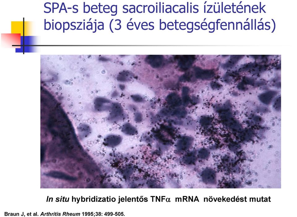 hybridizatio jelentős TNFa mrna növekedést