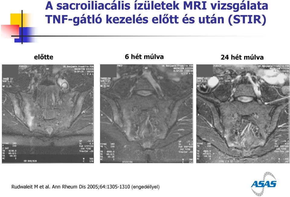 előtte 6 hét múlva 24 hét múlva Rudwaleit M