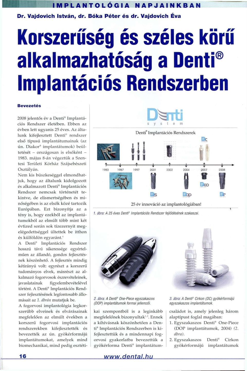 Az általunk kifejlesztett Denti rendszer első típusú implantátumainak (az ún. Diakor implantátumok) beültetését - országosan is elsőként - 1983.