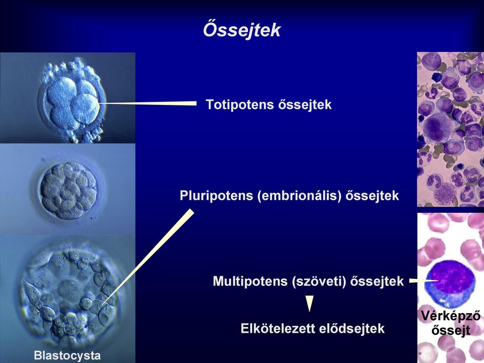 Multipotens (szöveti) őssejtek