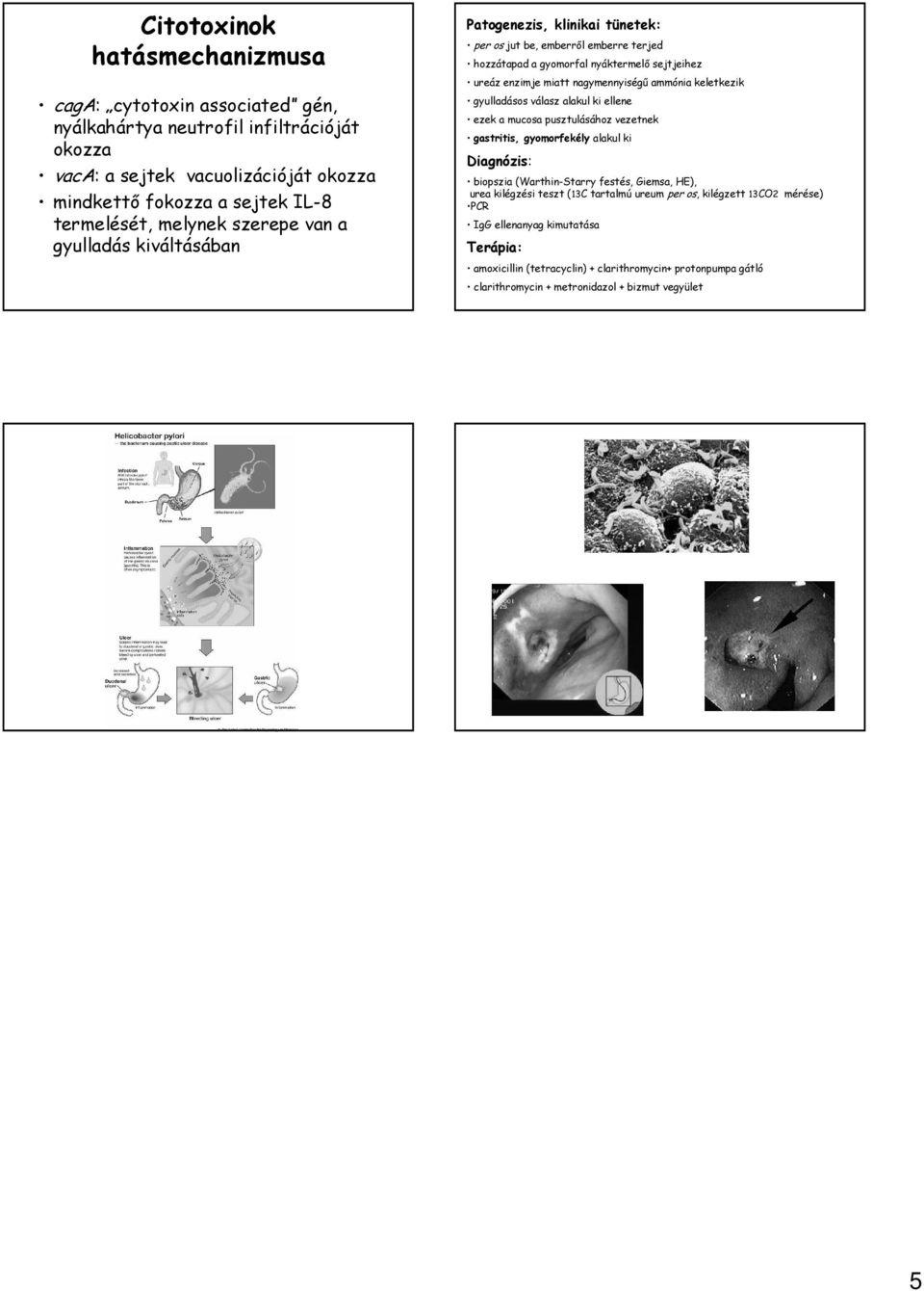keletkezik gyulladásos válasz alakul ki ellene ezek a mucosa pusztulásához vezetnek gastritis, gyomorfekély alakul ki biopszia (WarthinStarry festés, Giemsa, HE), urea kilégzési teszt