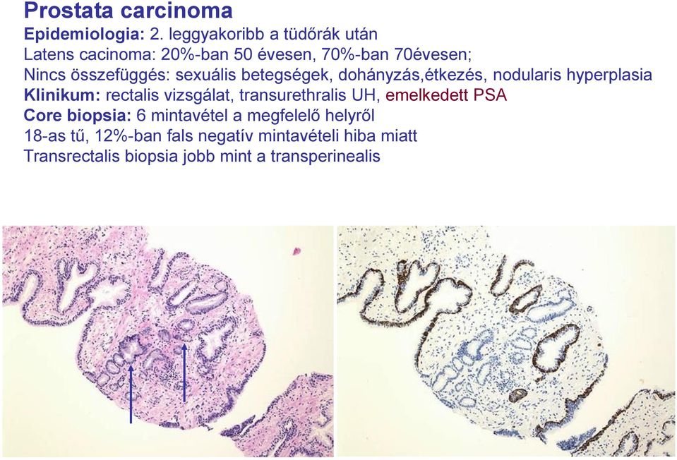 sexuális betegségek, dohányzás,étkezés, nodularis hyperplasia Klinikum: rectalis vizsgálat,