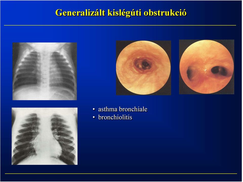 obstrukció